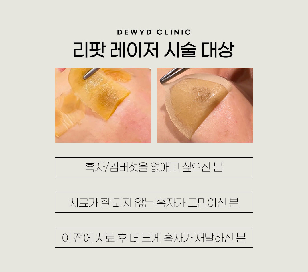 랜딩이미지